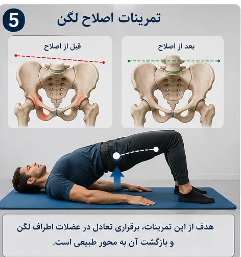 اصلاح لگن