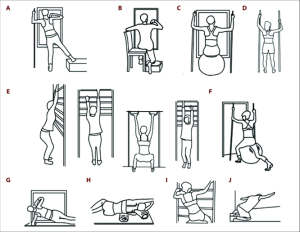 تمرینات برای درمان اسکولیوز