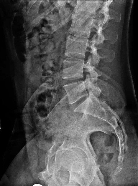 تمرینات ویلیامز