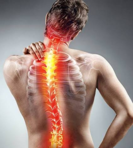 مدت زمان درمان اسکولیوز