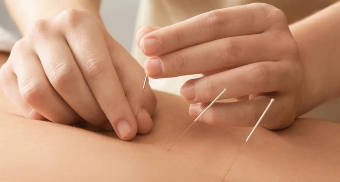 اسکولیوز چیست و چرا باید جدی گرفته شود