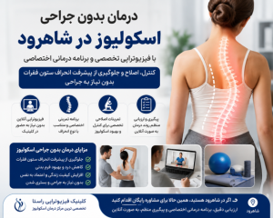 درمان بدون جراحی اسکولیوز در شاهرود