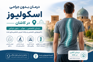 درمان بدون جراحی اسکولیوز در کاشان