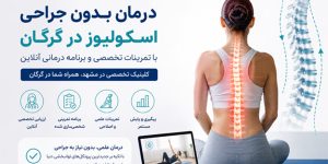 درمان بدون جراحی اسکولیوز در گرگان