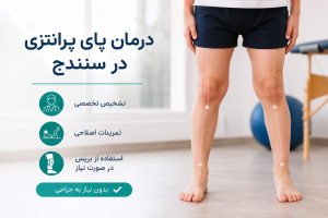 درمان پای پرانتزی در سنندج
