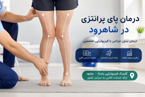 درمان پای پرانتزی در شاهرود
