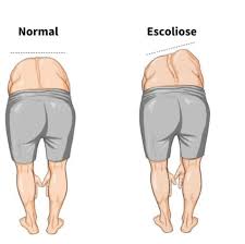 تست آدامز چیست